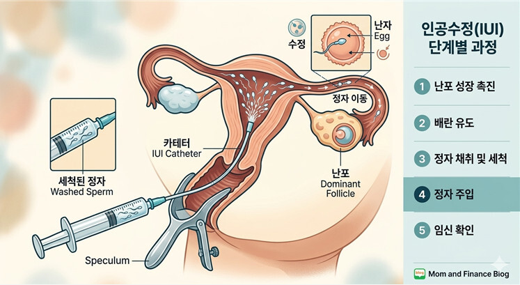 인공수정 이미지